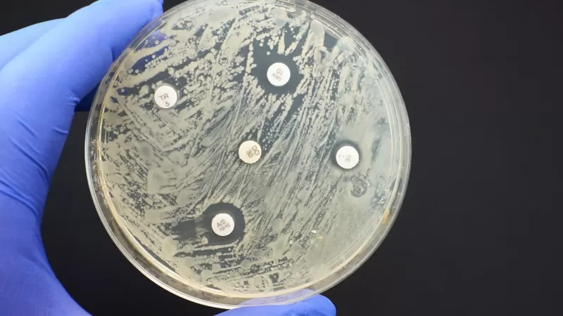 imagen noticia Las infecciones por bacterias resistentes a antibióticos matan más personas que la malaria y el sida
